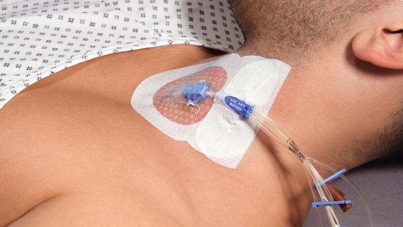 Curafix i.v. Control Katheterfixierung 9x11cm, 50 Stück, steril