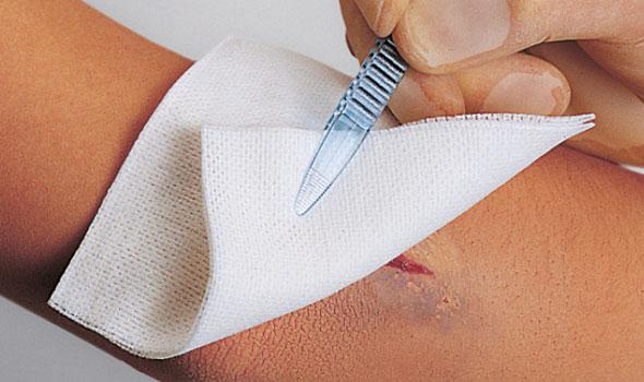 Vliwasoft Vliesstoffkompresse 10x10cm, 6-fach, 100 Stück